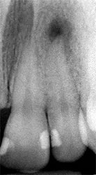 AntibioticsFigure1B AntibioticsFigure1B