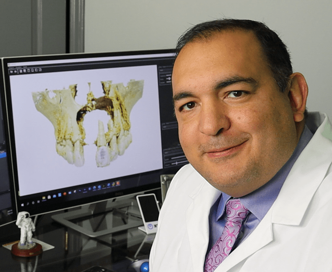 Azevedo_CBCT Azevedo_CBCT