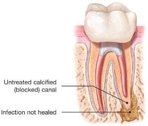 I'm Postponing Dental Treatment Because It's Not Bothering Me