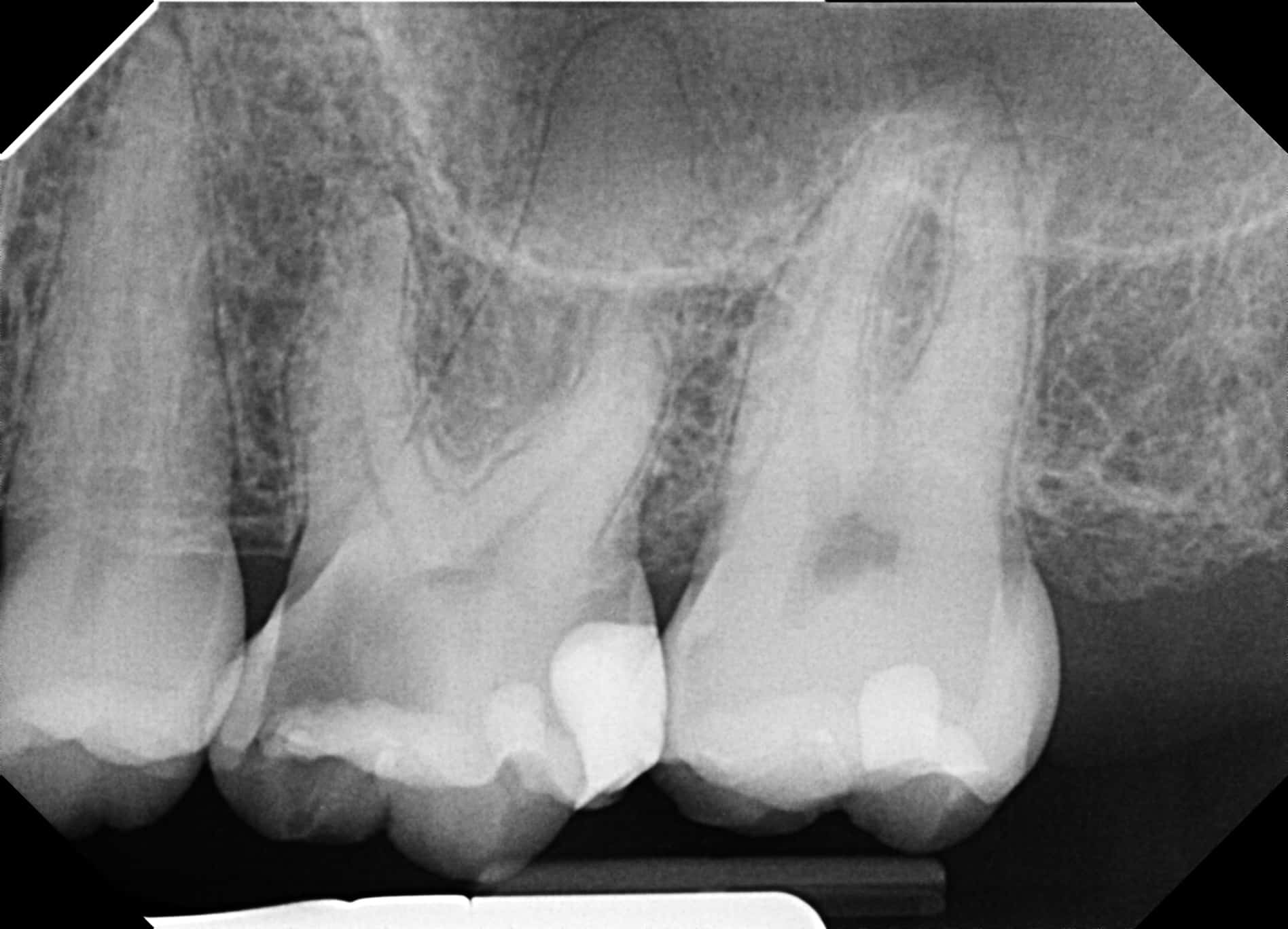 AAE Resident Case Study Winner Preop