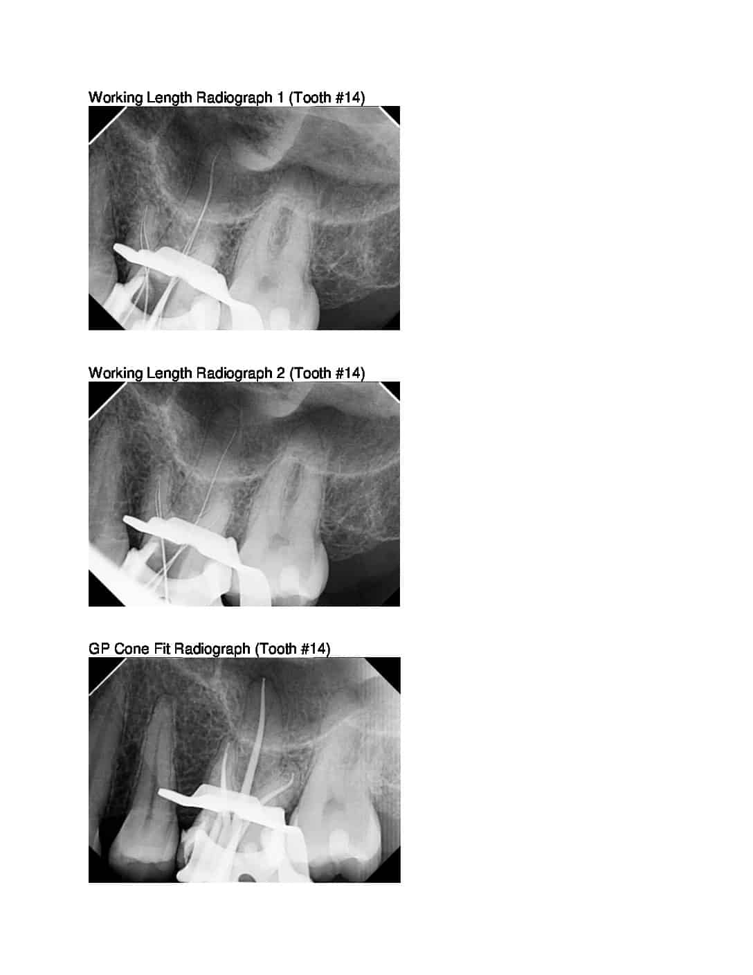 Working-Length-Radiographs - American Association of