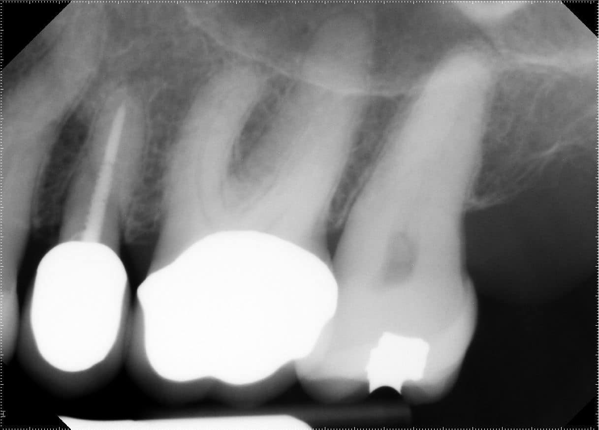 Case Challenge Figure 1 Pre-op PA from 2018