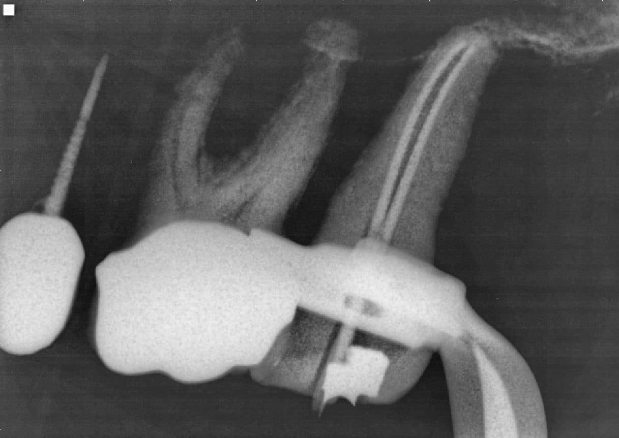 Case Challenge Figure 2 Master cone PA from 2018