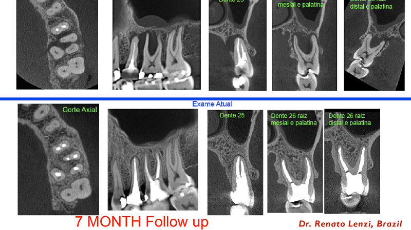 CBCT imagery