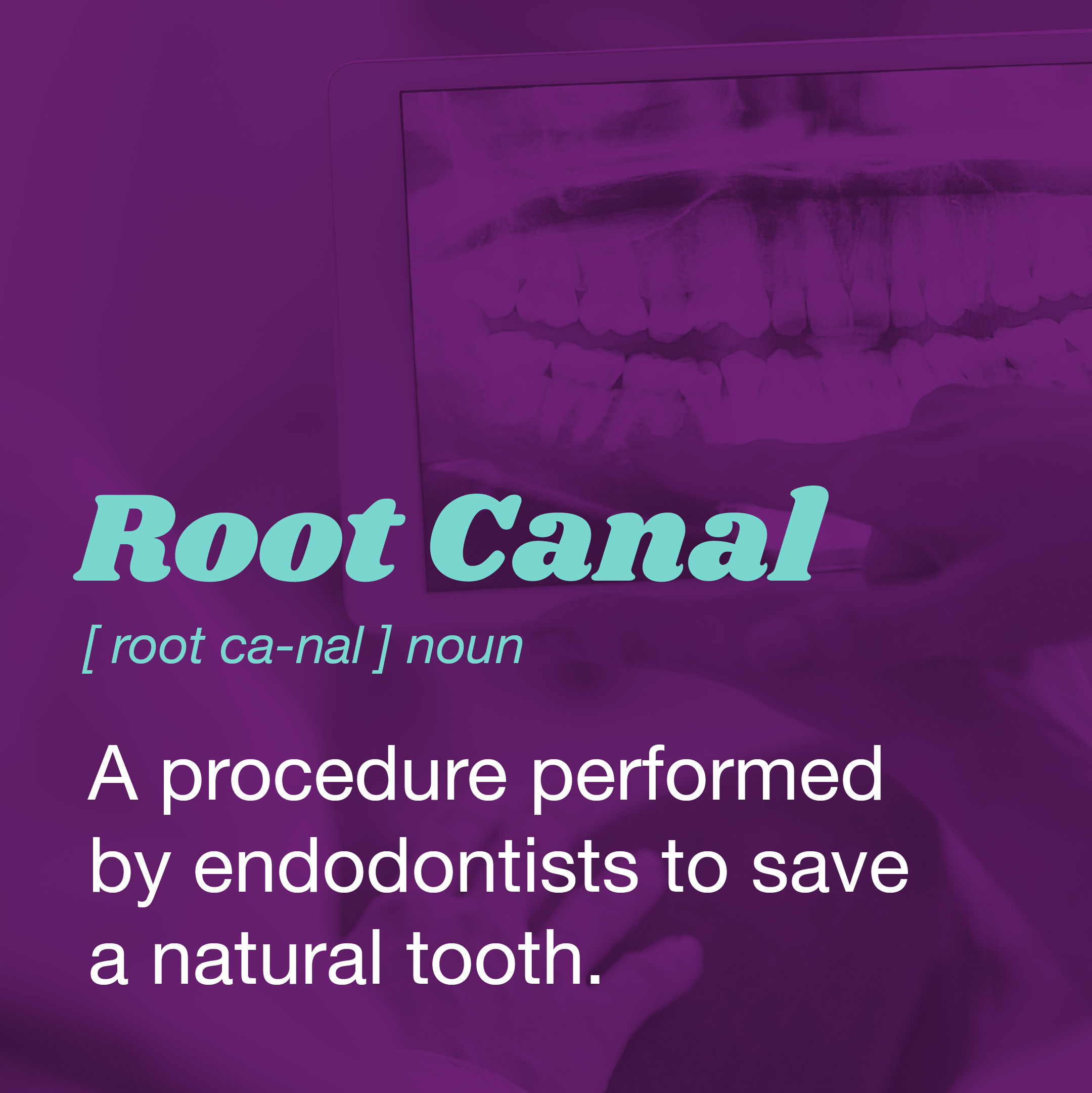 Rootcanaldefinition American Association of Endodontists